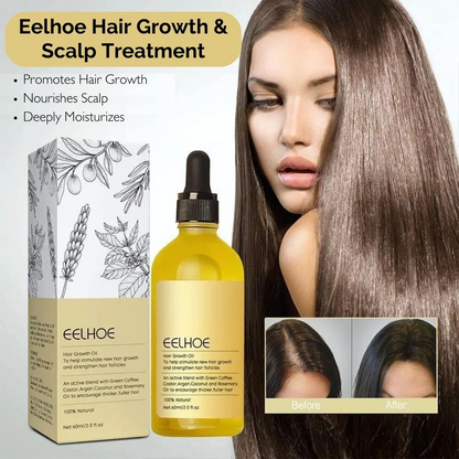 Aceite Esencial Capilar Vegano – Fortalece y Estimula el Crecimiento del Cabello